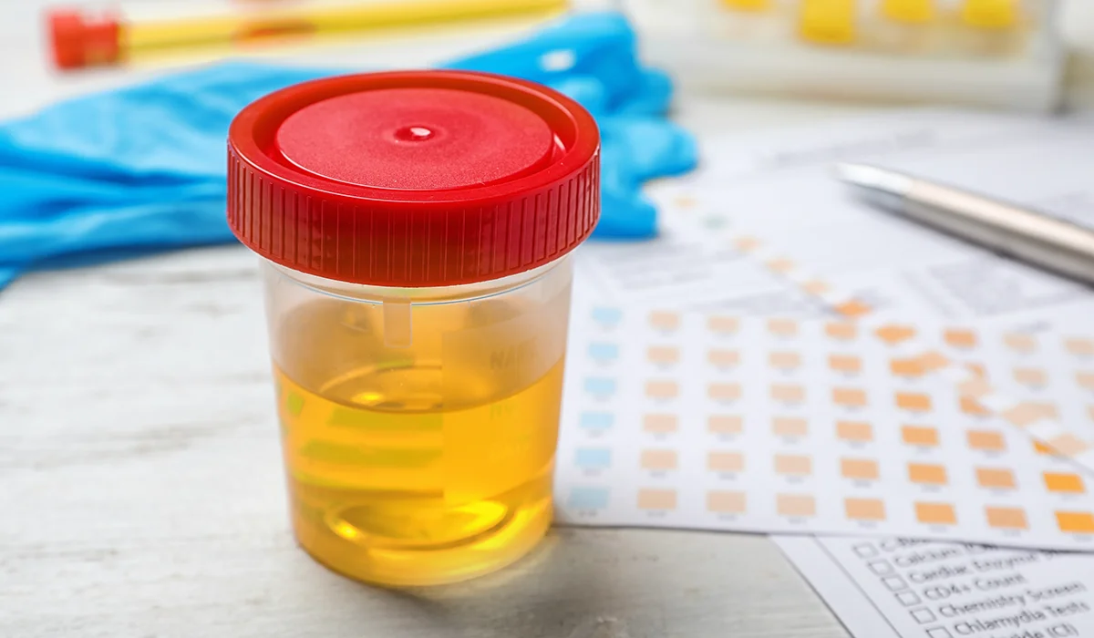 urine drug testing